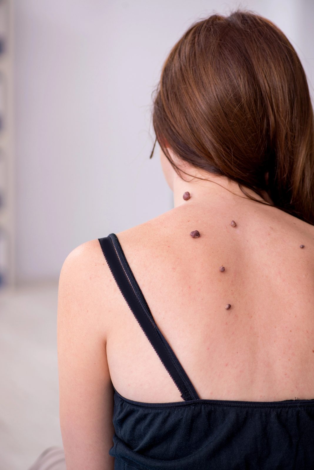 Odstranjevanje znamenj je bila odlična odločitev